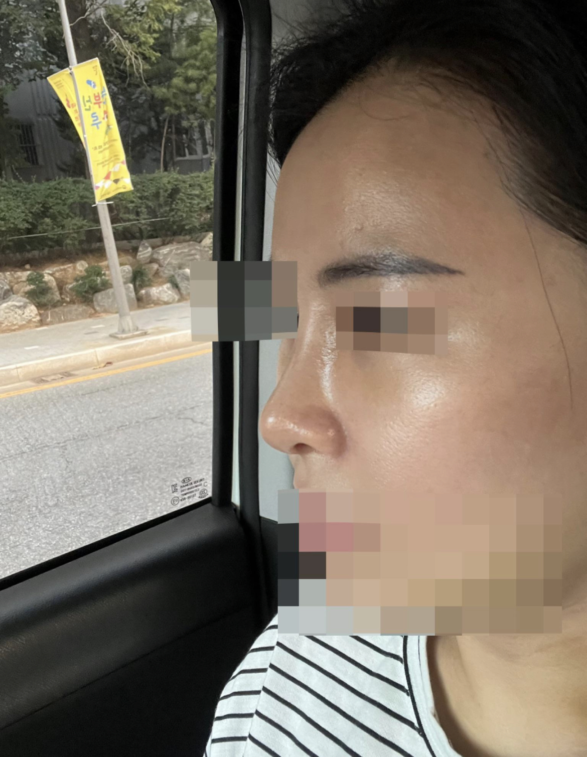 황정일 원장님 친절하시고 직원들도 너무 좋아요^^