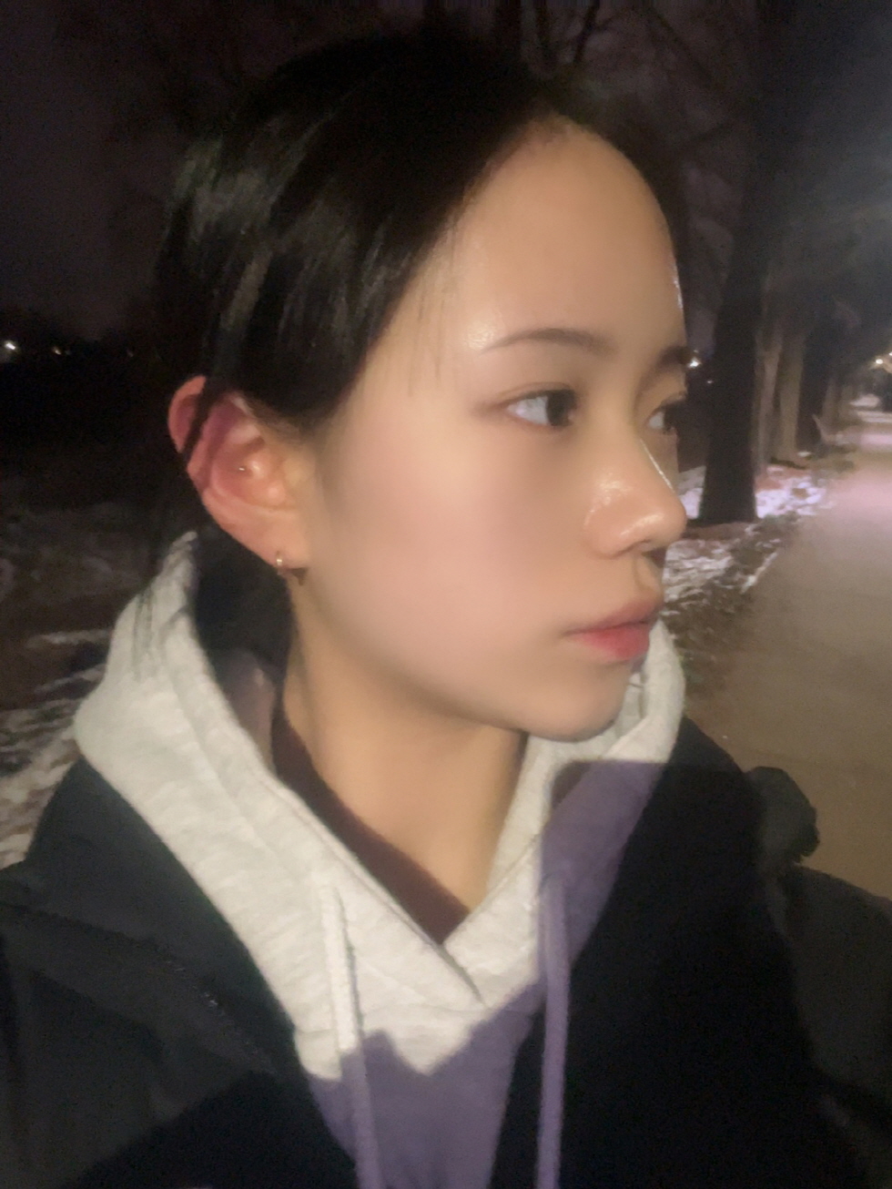 콧대는 있어서 코끝만 했는데 너무 만족스러워요