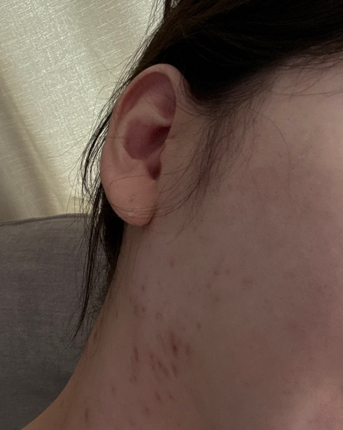저한테 잘 맞는 스킨부스터 리쥬란, 이번에도 받아봤어요!!