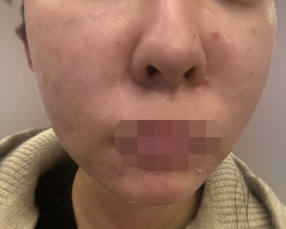 속건조 때문에 1년 넘게 다니는데 가격도 만족이에요~~ㅎㅎ