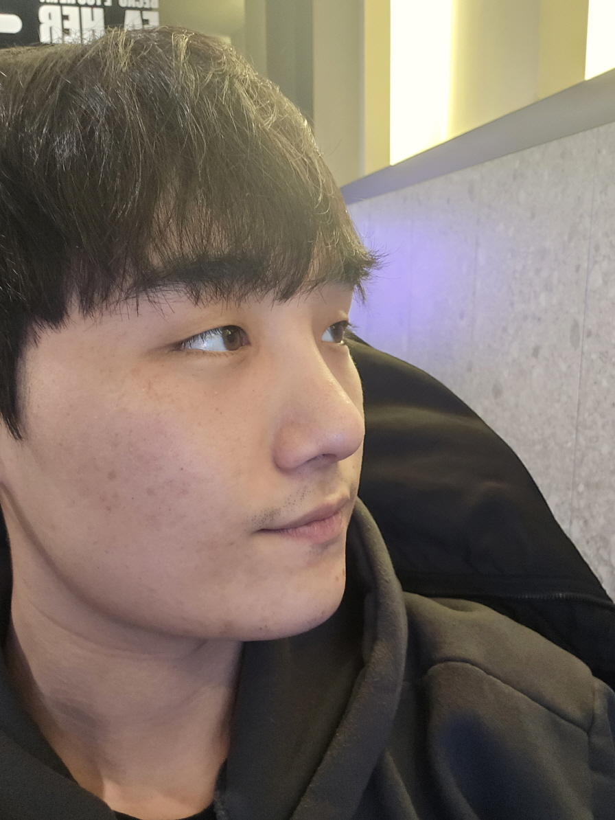 생각보다 더 통증도 없고 너무 만족합니다~