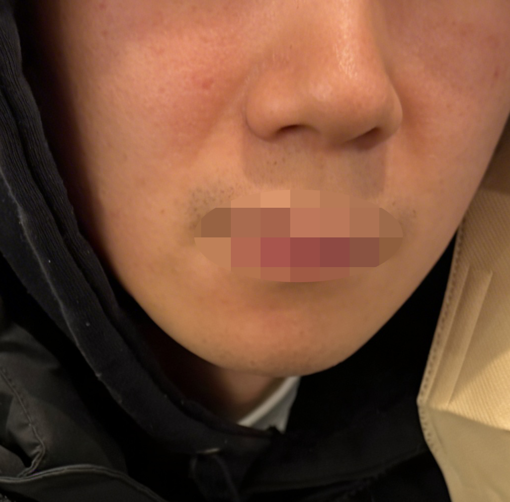 와이프따라 왔는데 피부가 빠르게 윤기 나서 만족입니다!