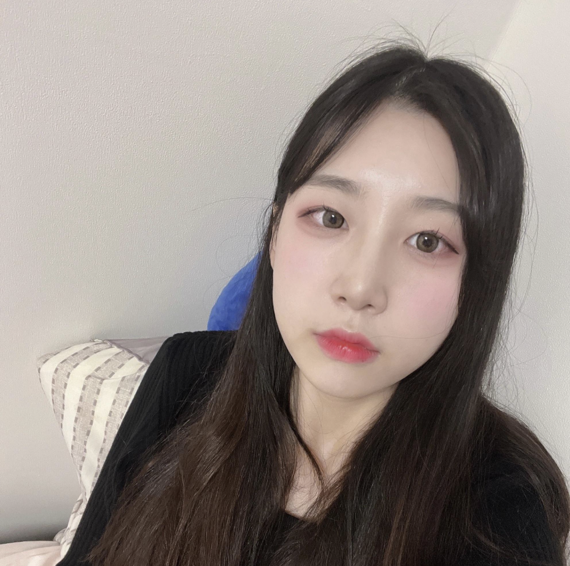서울아이성형외과에서 수술한 지 한달차에요