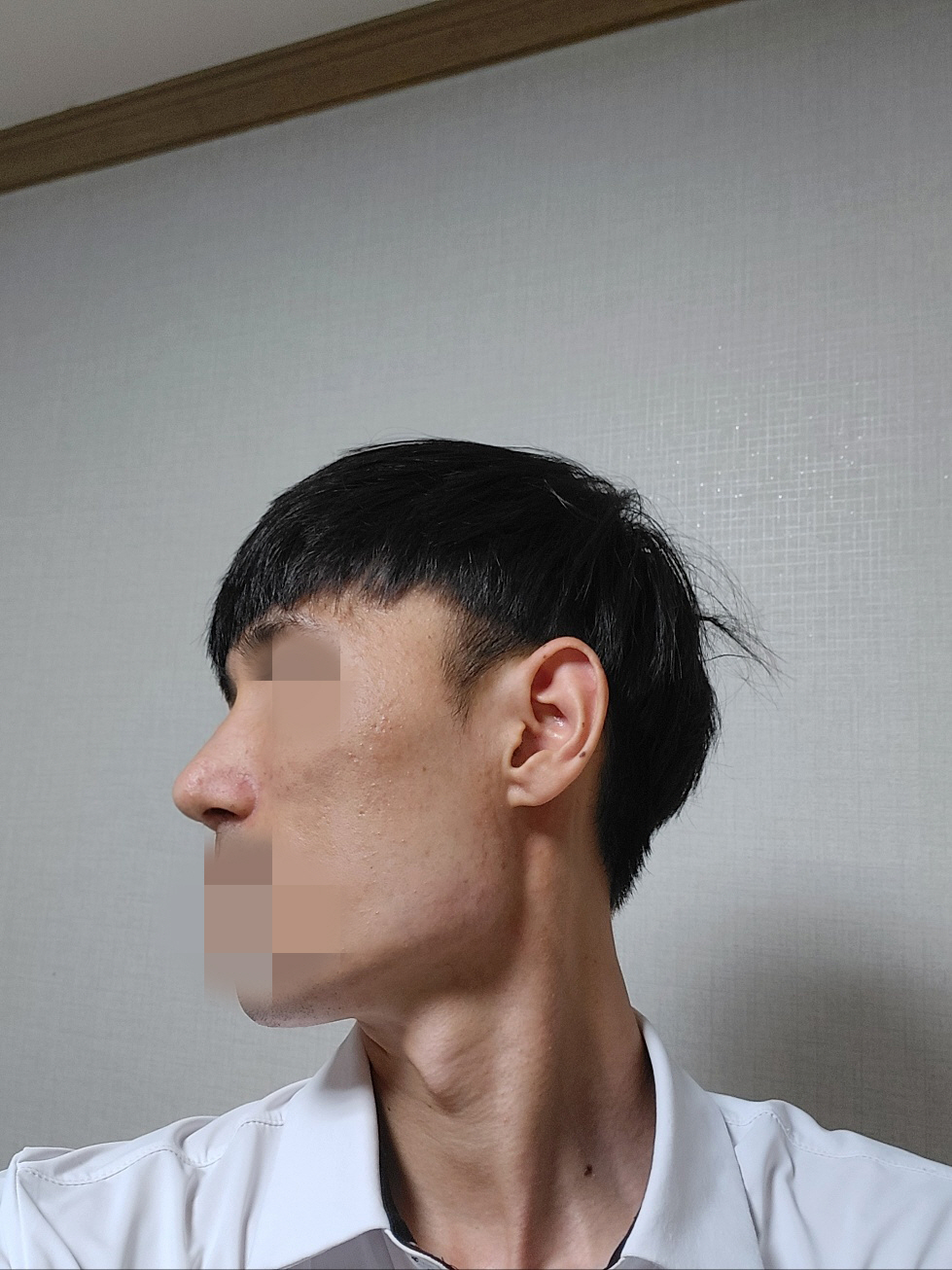 오랫동안 알고 지냈던 주변 지인들로부터 수술 잘했다고 얘기들을 때가 기분이 좋은 것 같습니다