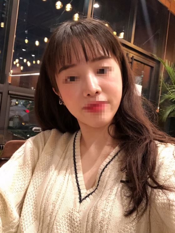 원하던 코 됐어요