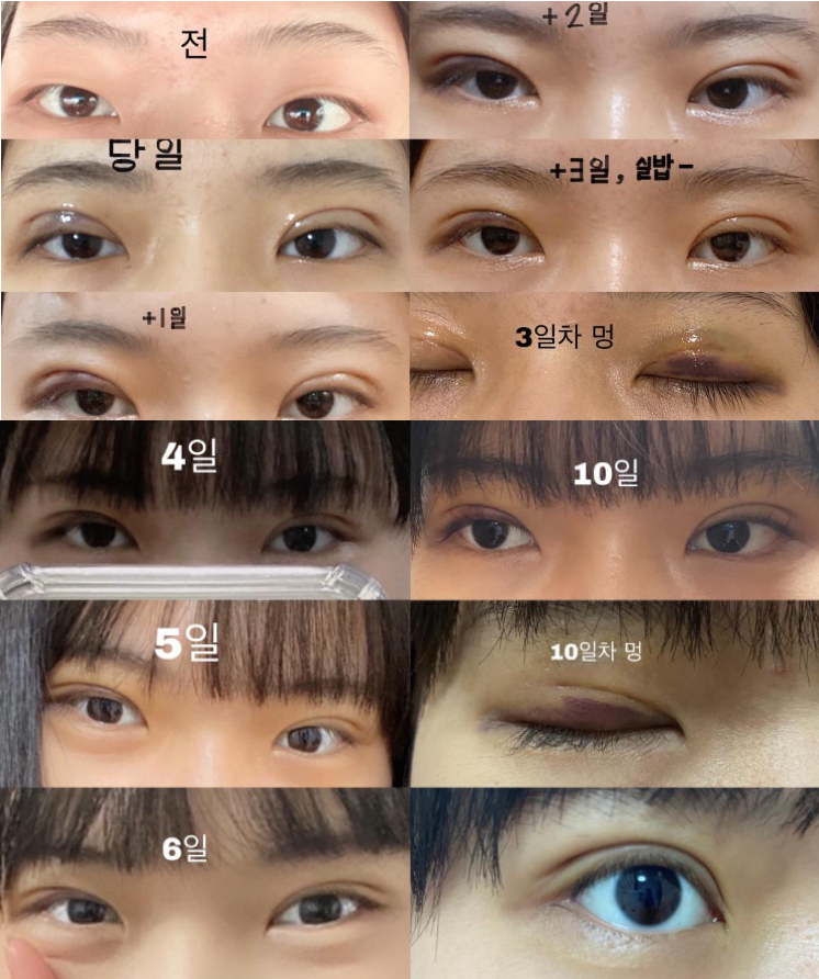 자연유착했습니다