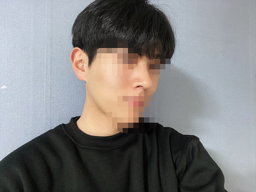 갈수록 코 모양이 더 자연스러워지고 예뻐지는 게 느껴져서 하루하루 행복하네요.