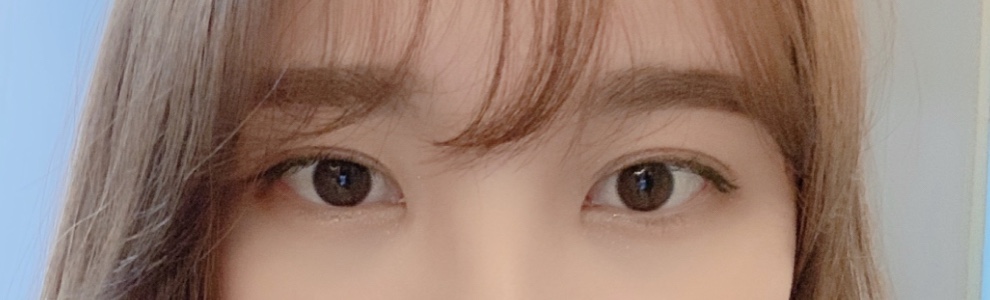 쌍수후기 :)