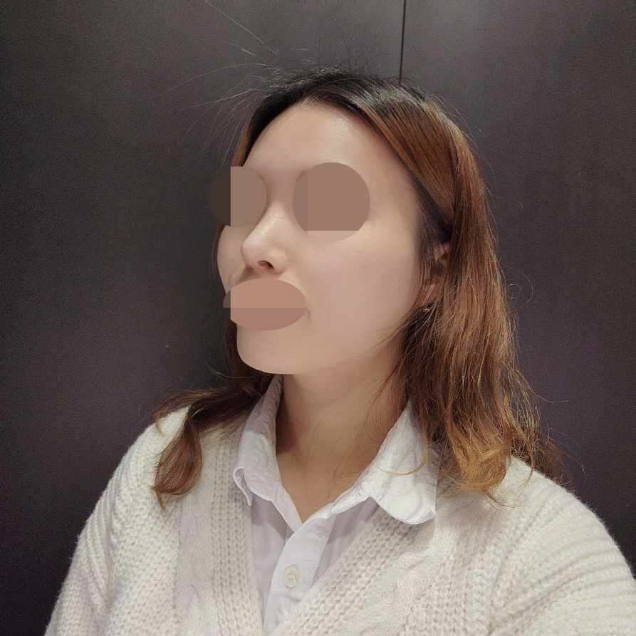 제가 원하던 예쁜 코로 잘 돼서 너무 좋아요 ㅎ