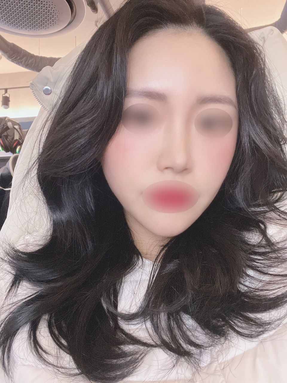 코 재수술★
