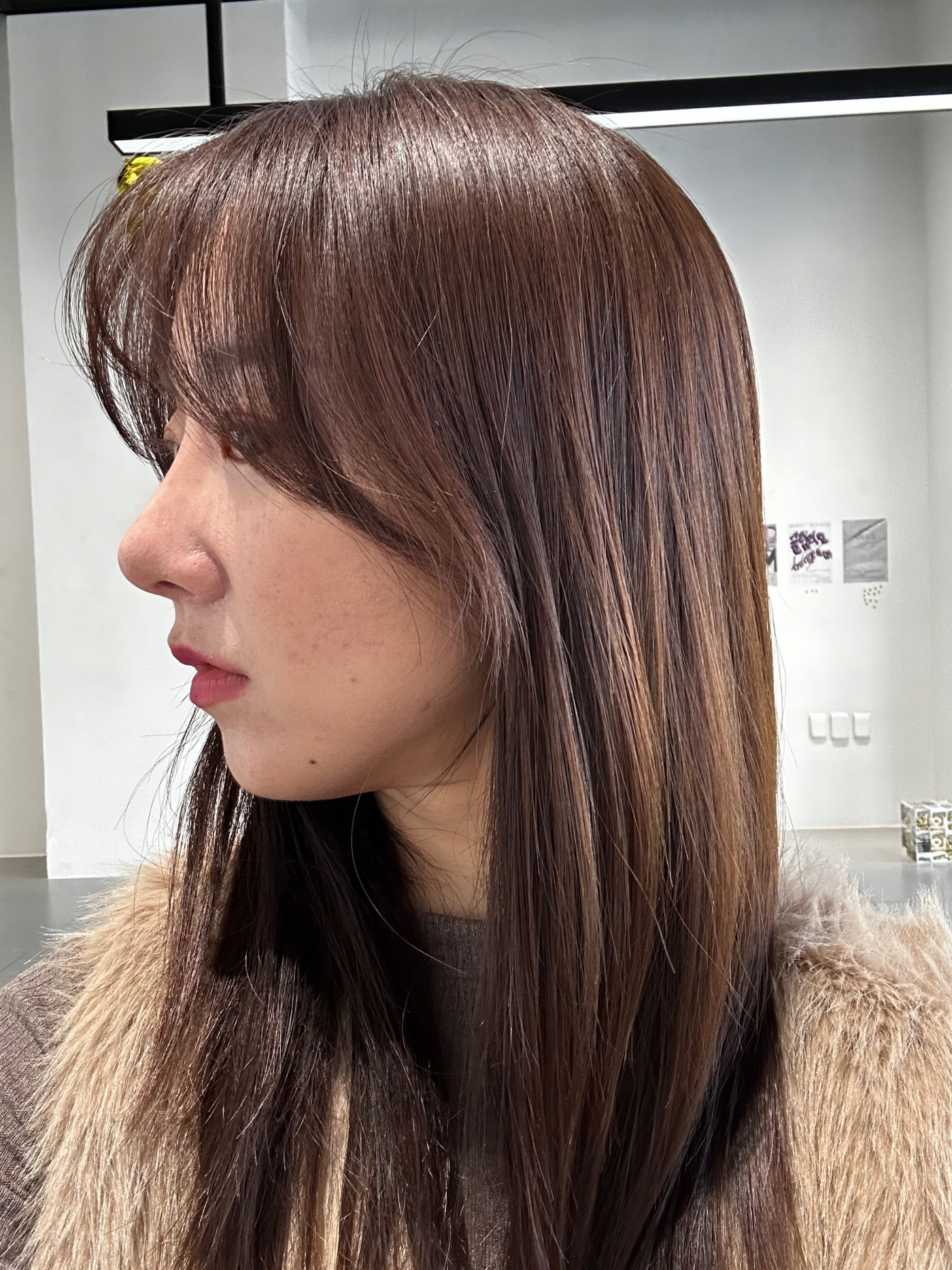 얼굴에 균형미가 더해지고 인상이 한층 세련되어져서 정말 만족스러워요.