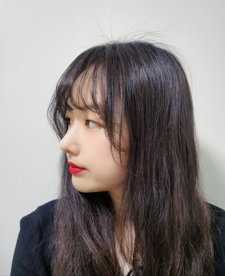 매부리도 엄청 없어지고 코 모양도 이뻐져서 너무 좋네요.