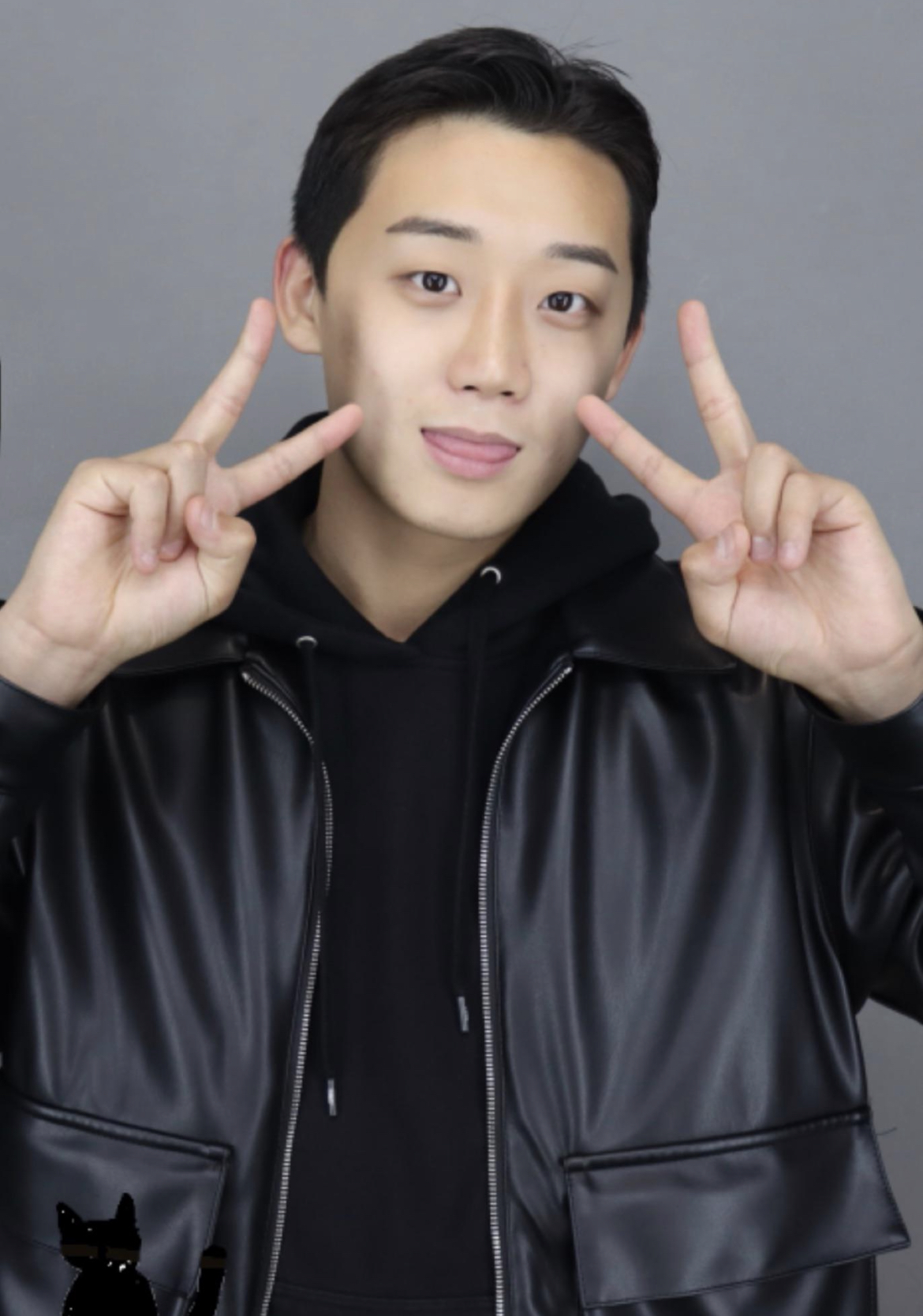 코끝, 휜코, 콧볼 등 코 수술을 너무 잘해주셨어용