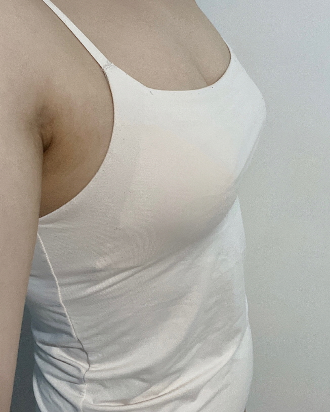 멍도 다 빠졌고 통증도 이제 괜찮아요! 첨보단 빠졌지만 이전보다는 확실히 큰게 보입니다~~