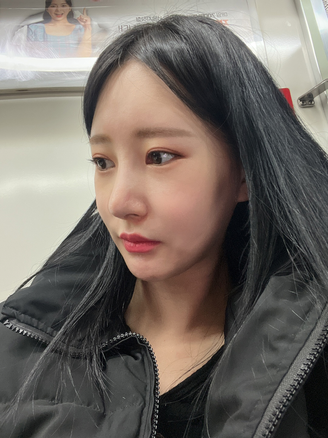 코 수술 받은지 벌써 2주차가 됐네요