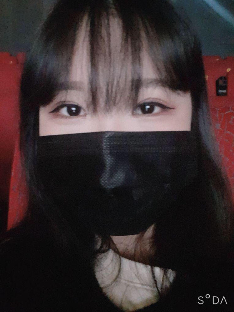 앞틈, 눈교, 쌍꺼풀