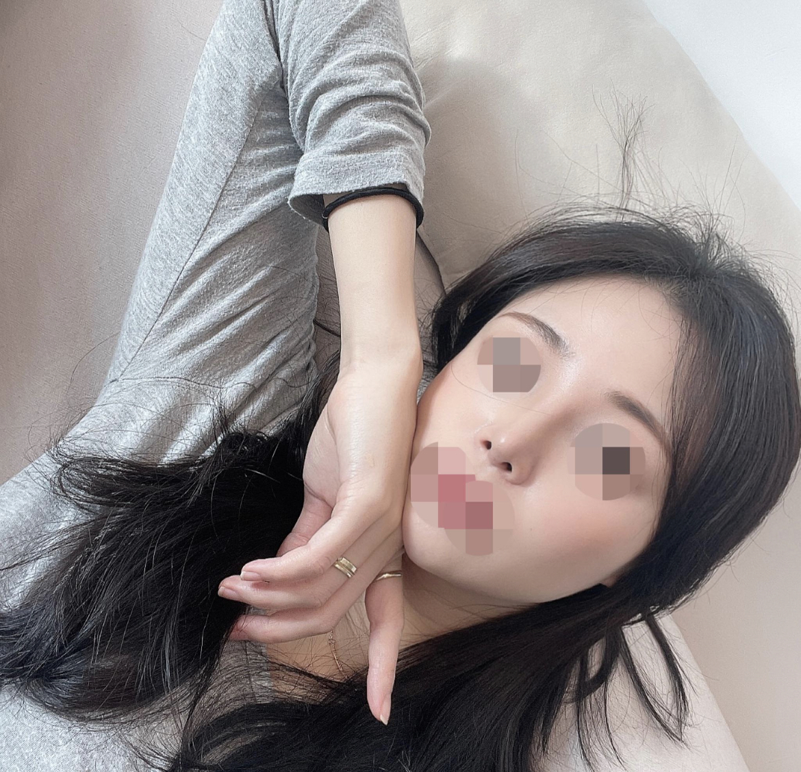 없던 콧대가 생기구 너무 행복합니당♥♥♥