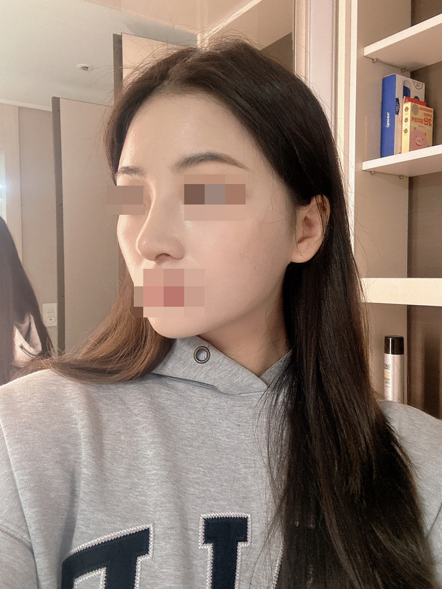 황원장님이 제일 꼼꼼 +친절+과학(?)적으로 잘 설명해주셔서 믿음이 갔어요! 결과도 성공 !