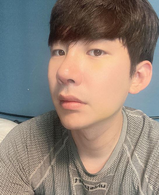 남자 코수술 후기