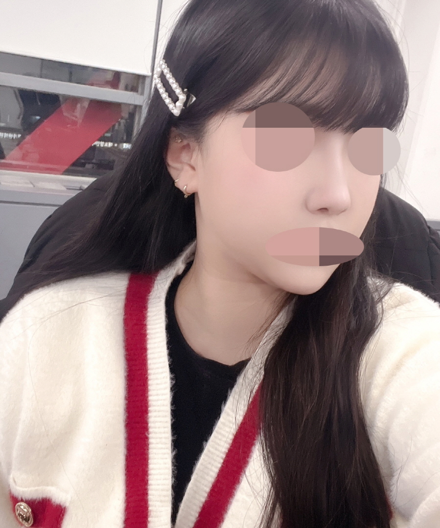 본인의 얼굴에 맞는코로 예쁘게 잘 해주셔서 요즘은 사진도 많이 찍어요!