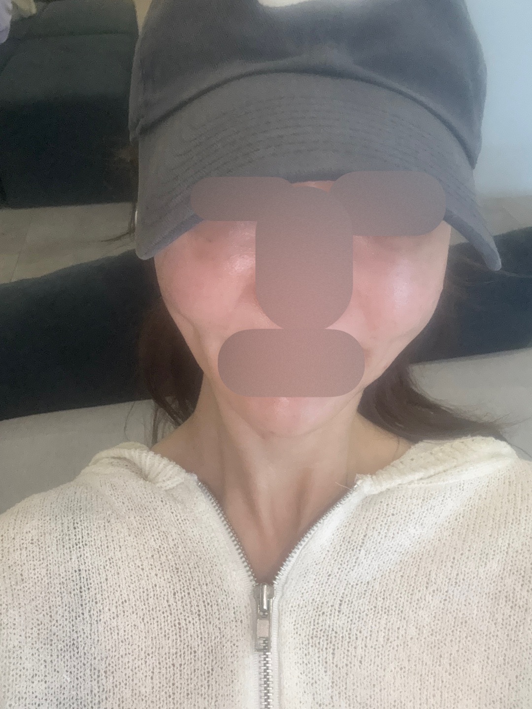 인모드 꾸준히 받으니 얼굴 라인 확실히 달라진 것 같아요
