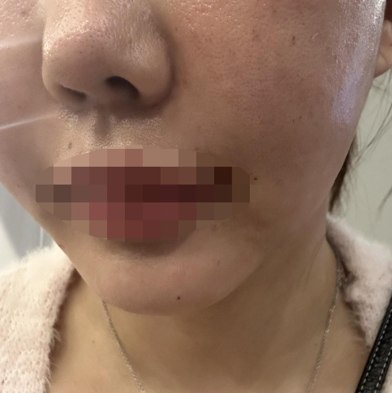 푸석한 피부 때문에 받았는데 편하게 잘 받은 것 같아요~