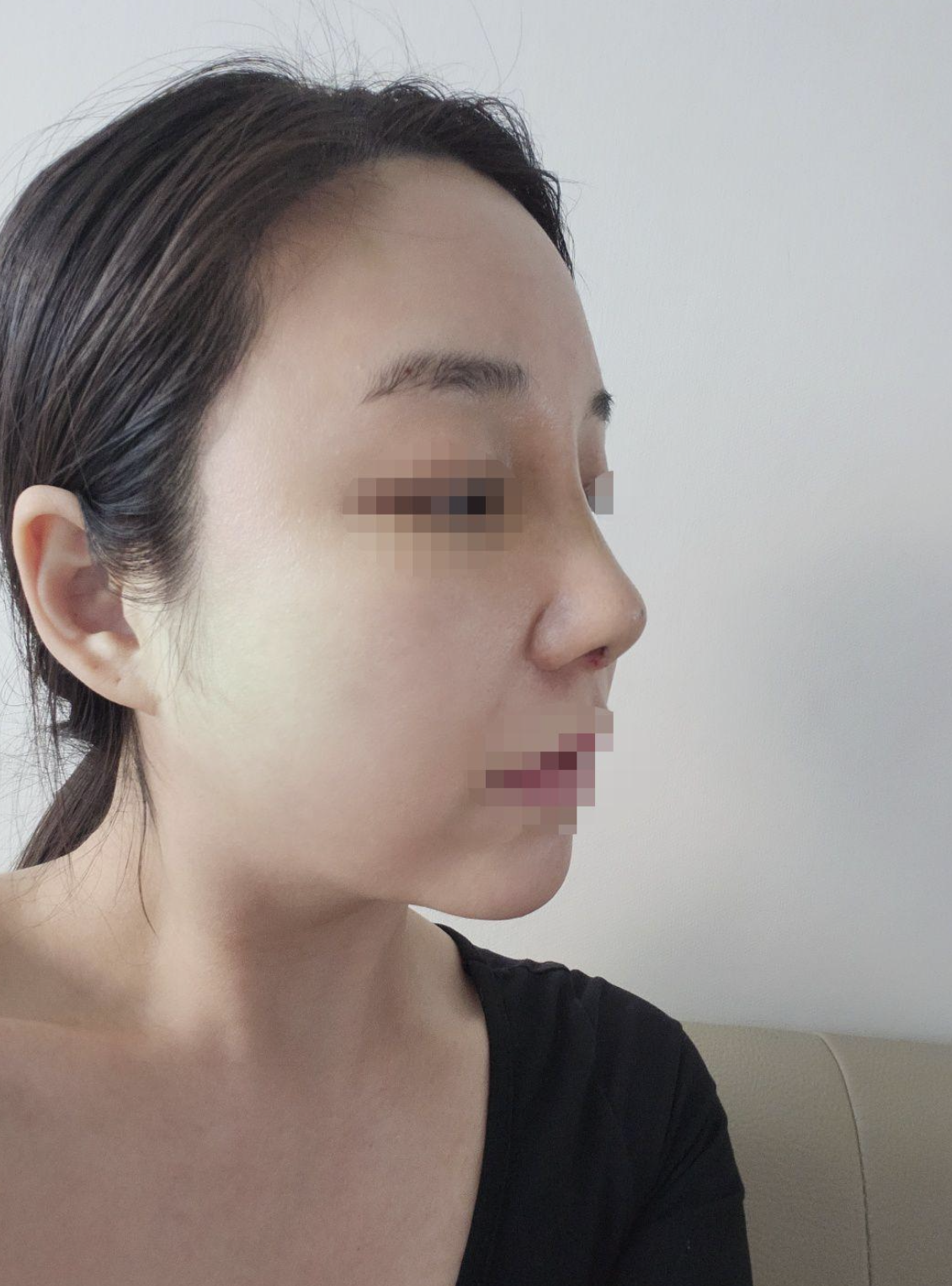 숨 쉬기 힘들어서 일주일이 가장 힘들었는데 지나고 나니 너무 좋네용ㅎ