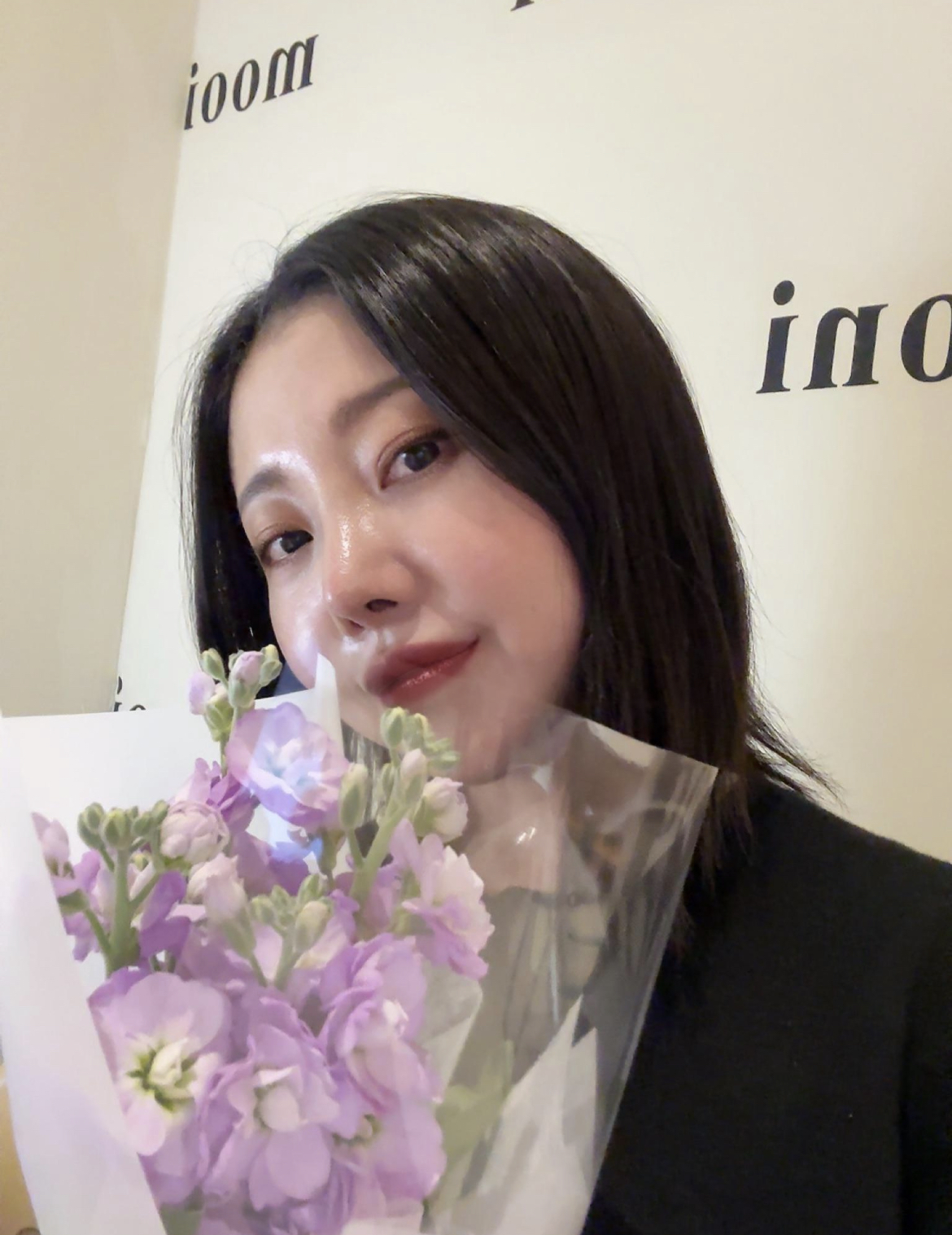 코재수술 2주차 후기남기러 왔어용