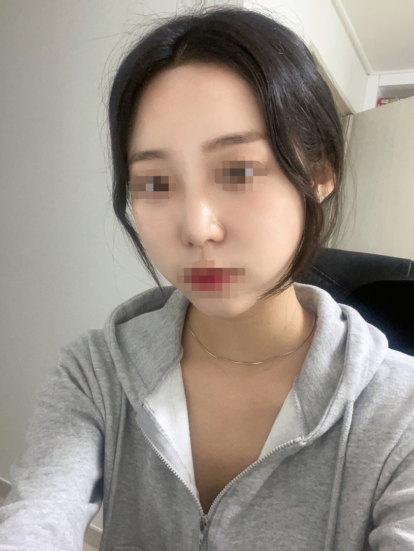 자연스럽게 돼서 주위에서 잘 됐대용!!