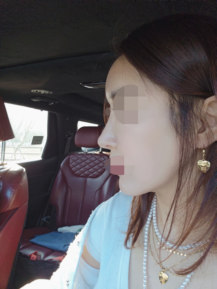 고민되었던 부분 여기서 재수술하고 만족스럽게 해결되었어요