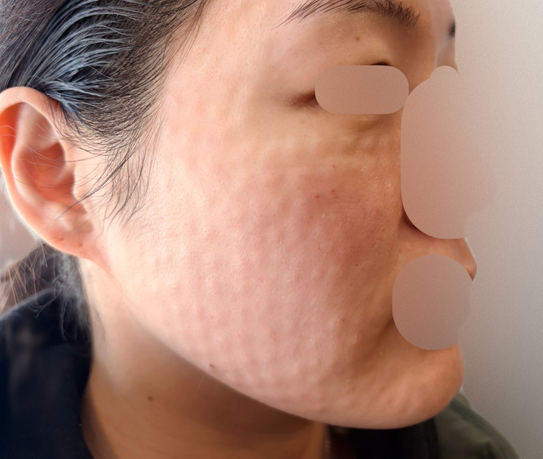 데 꼼꼼해서 효과 좋으면 또 오려고요 ㅎㅎ