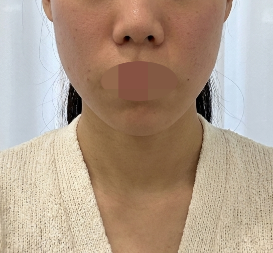 친구 소개로 방문, 병원 분위기부터 시술까지 다 만족이에요~