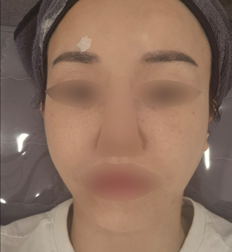 리쥬란 받았는데 한땀한땀 장인정신 느껴져서 재방문 했어요!!