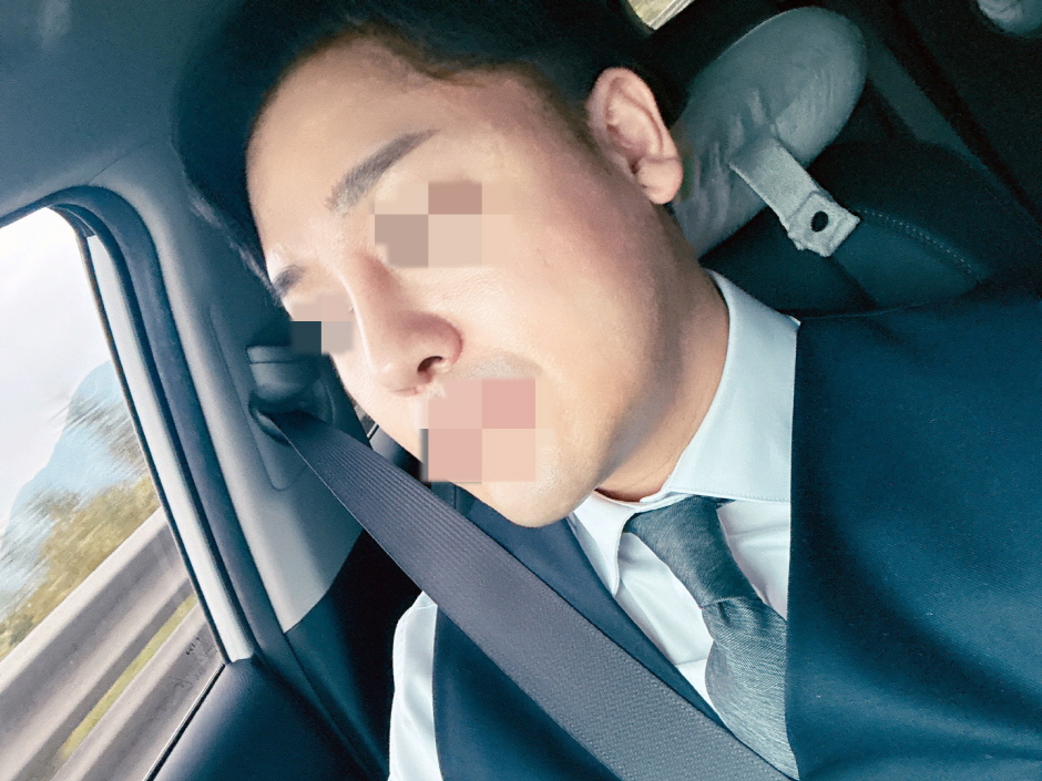생각보다 붓기가 많지 않았고 주변사람들도 자연스럽다고 괜찮다고들 하네요