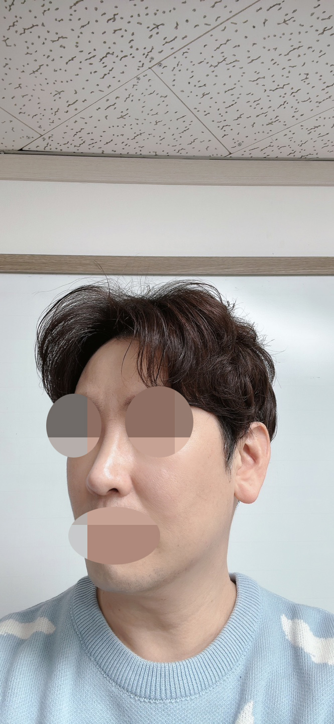 수술 잘 됐습니다~