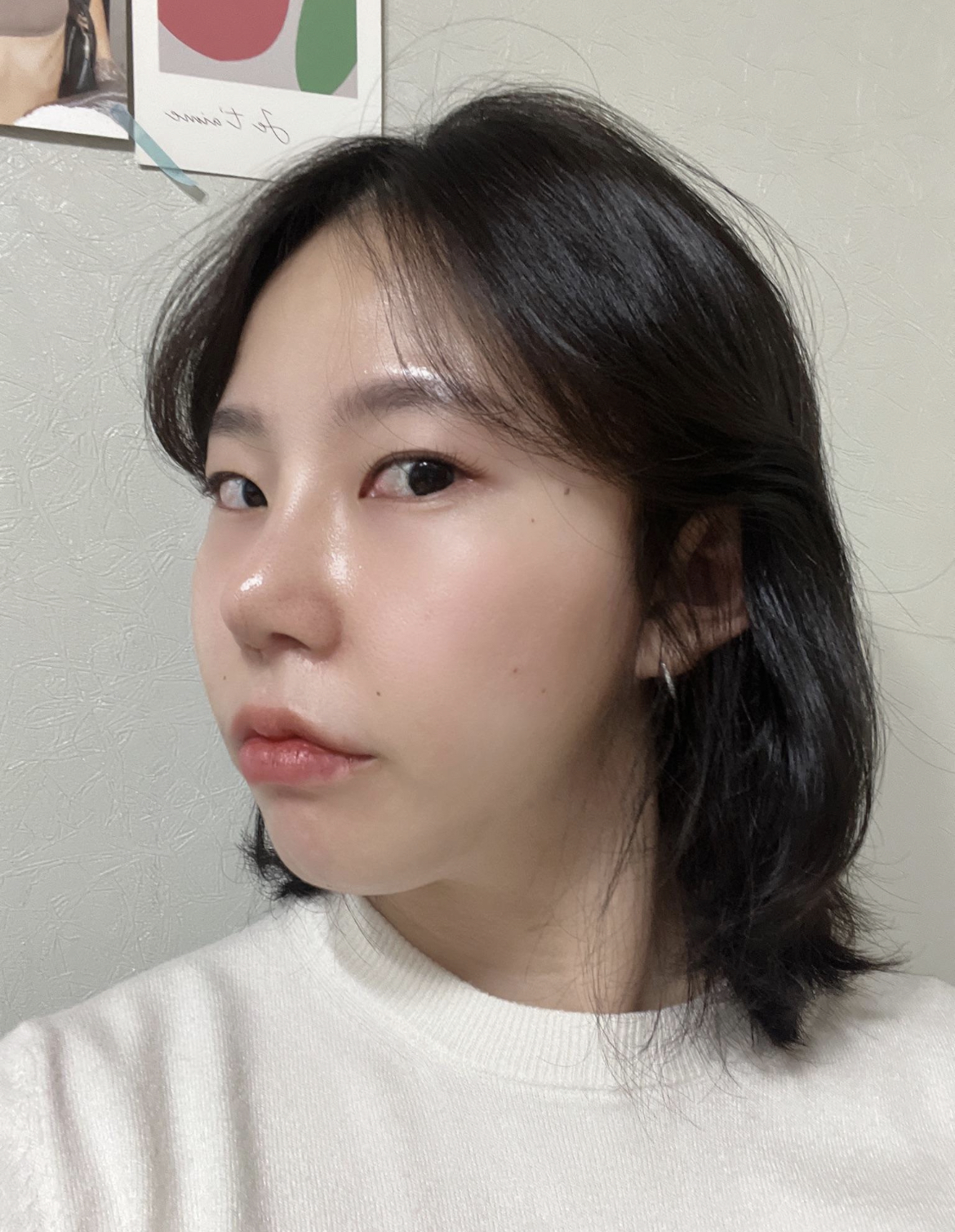 붓기가 많이 빠지고 자연스러워졌다고들 이야기 해주셔요!