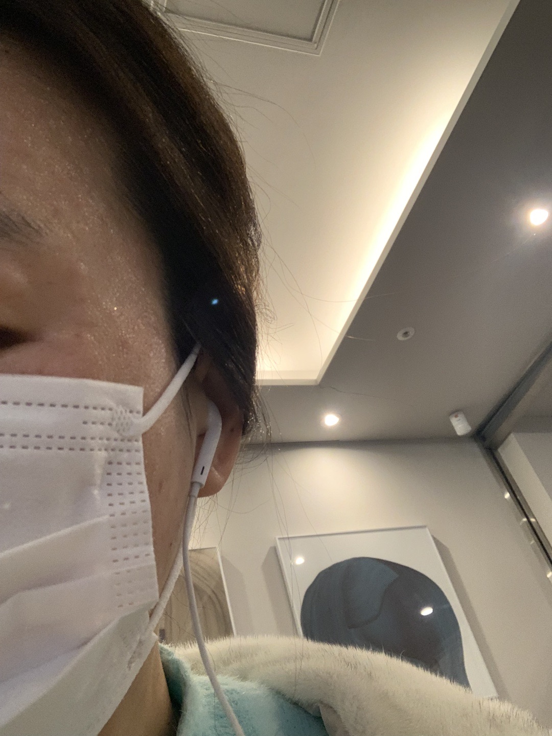 리쥬란 맞으면 멍 걱정했는데 여긴 멍자국이 없어요~
