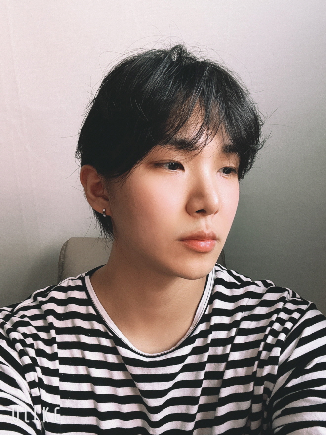 부작용 없이 이쁘게 자리잡혔어요