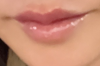 짧은 대기에 만족스러운 상담, 입술필러는 여기서 받기로 했어요~