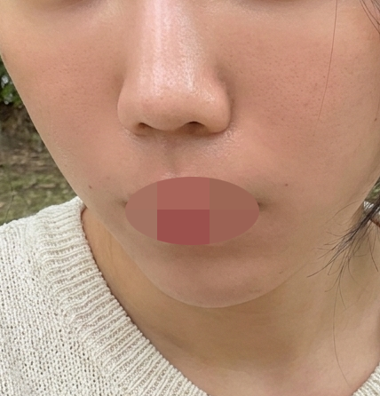입체감 없던 얼굴, 레디어스로 자연스럽게 채워봤어요ㅎ