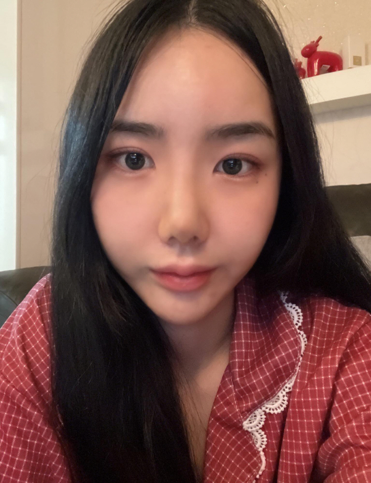 코가 얄쌍해졌어요