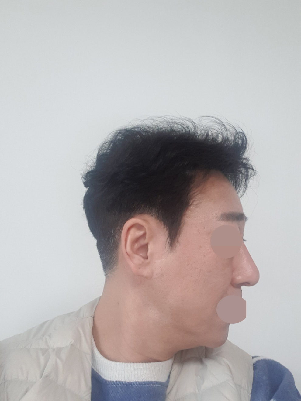 마음편히 잘 수술받았습니다^^