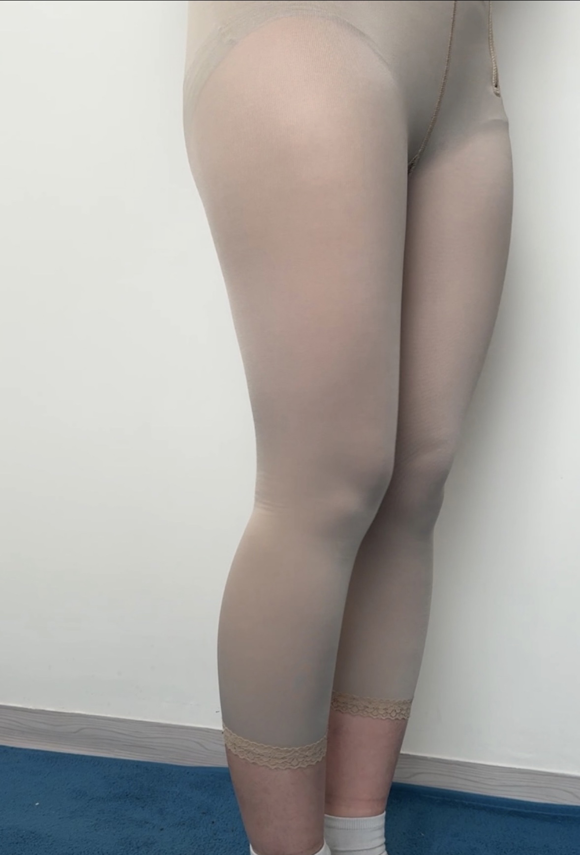 허벅지 지흡 1달차, 자연스럽게 정리되는 라인 마음에 들어요!