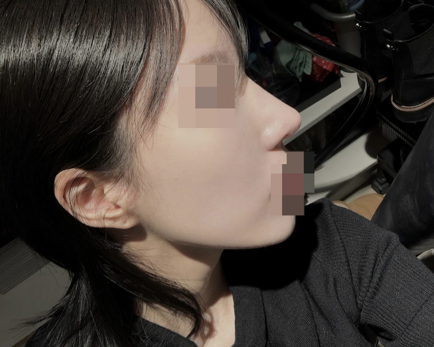 수술티 안나게 자려하게 잘 된것 같아서 만족해요!