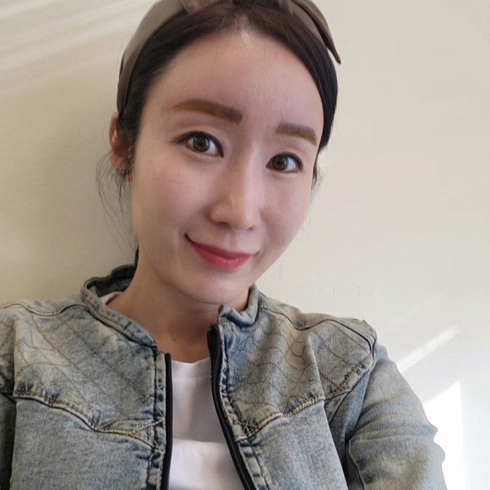 3개월인데 붓기도 많이 빠지고 자연스러워서 만족해요