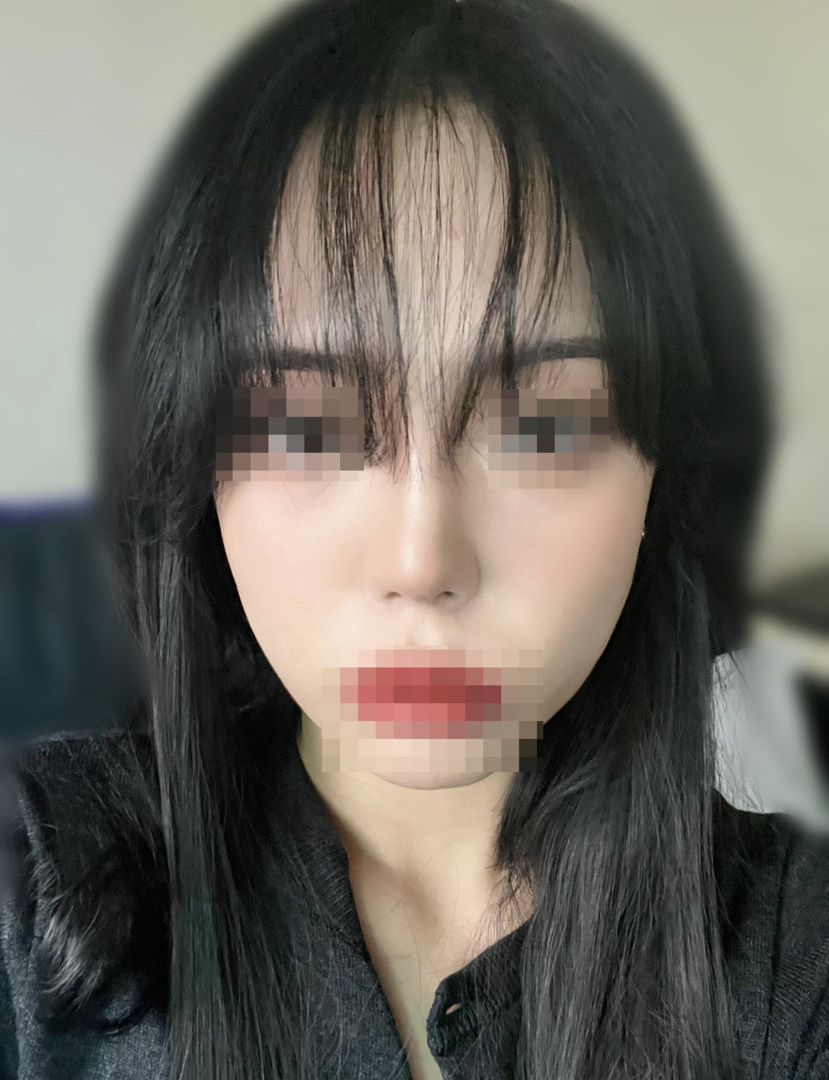 코성형으로 유명한 병원은 다르네요!!