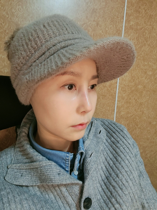 멍 잘드는체질인데 케어 잘해주셔서 빠르게 회복중이예요