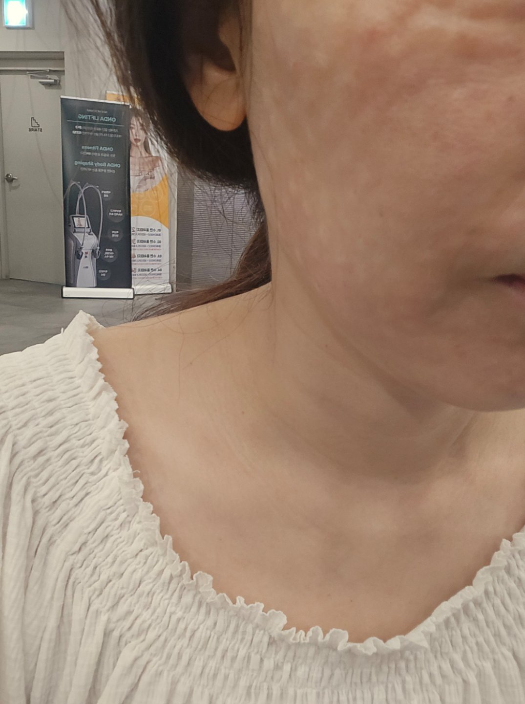 생기 없고 푸석해진 피부 고민으로 리쥬란 받으러 방문했어요!