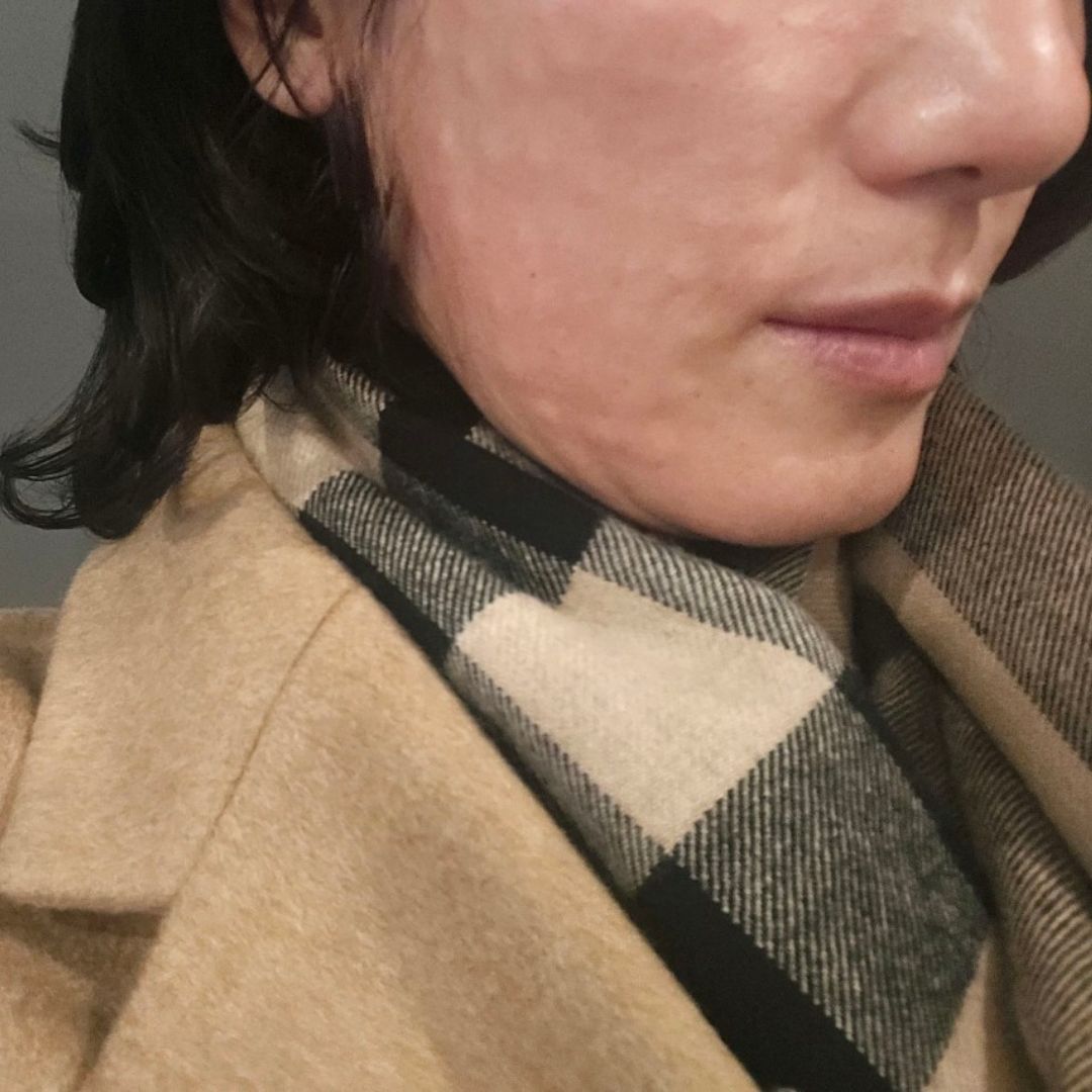 리쥬베룩으로 세 번 관리 후 피부결 달라졌다는 말 많이 듣고있어요