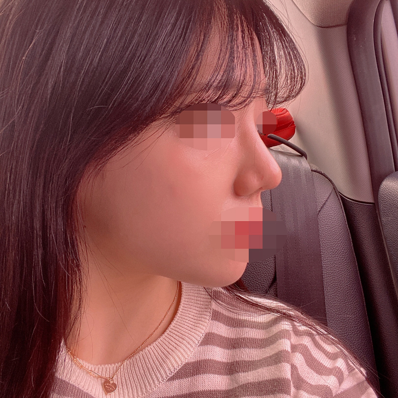 병원 상담도 너무 잘해주셨구 실장님도 친절하셔서 너무 좋았어용